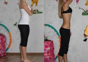 6-petal diet before and after photos